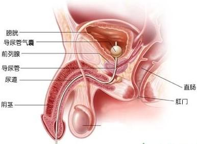 前列腺痛不治會引起哪些并發(fā)癥