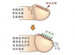 習(xí)慣性早泄要做哪些檢查