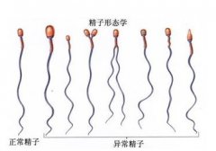 弱精的危害