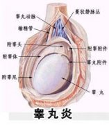 男人“蛋疼”小心患上了睪丸炎